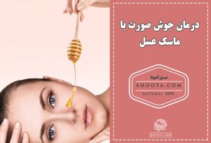 ماسک عسل برای جوش صورت و 9 درمان خانگی آکنه