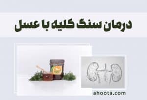 خواص عسل برای کلیه + روش درمان سنگ کلیه