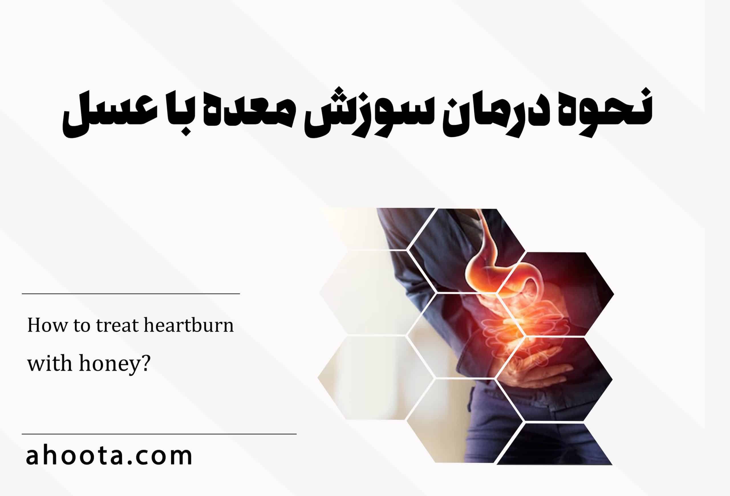 نحوه درمان سوزش معده با عسل