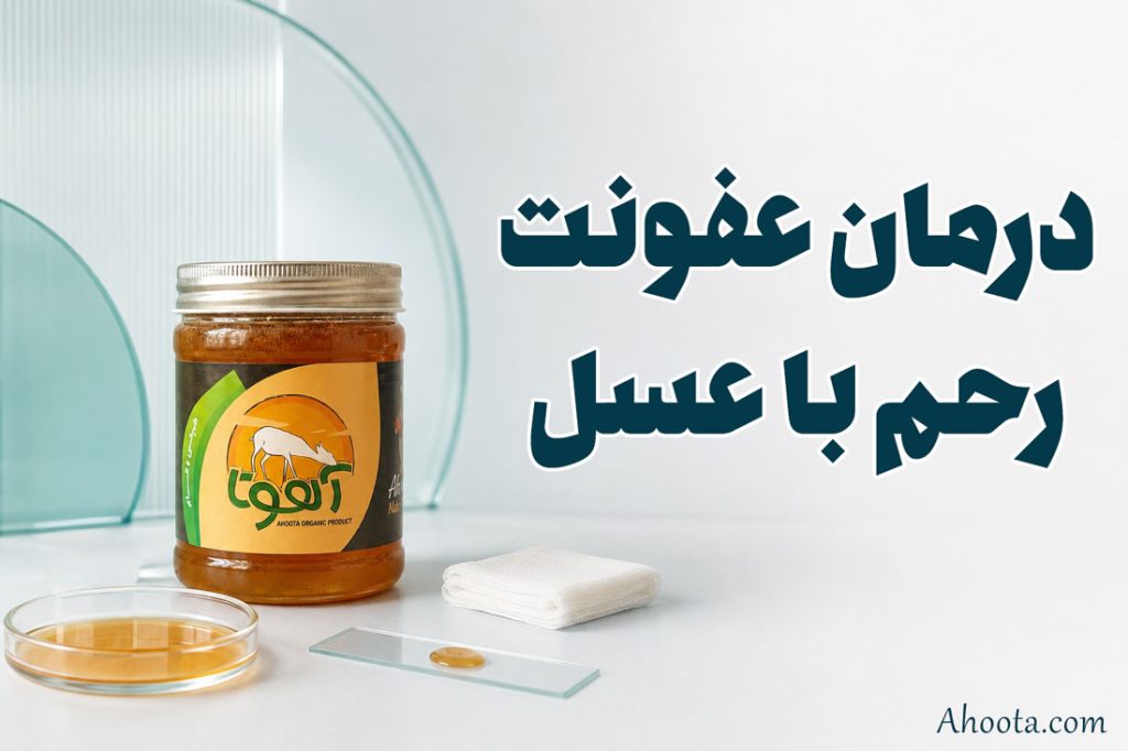 عسل برای عفونت رحم خوبه